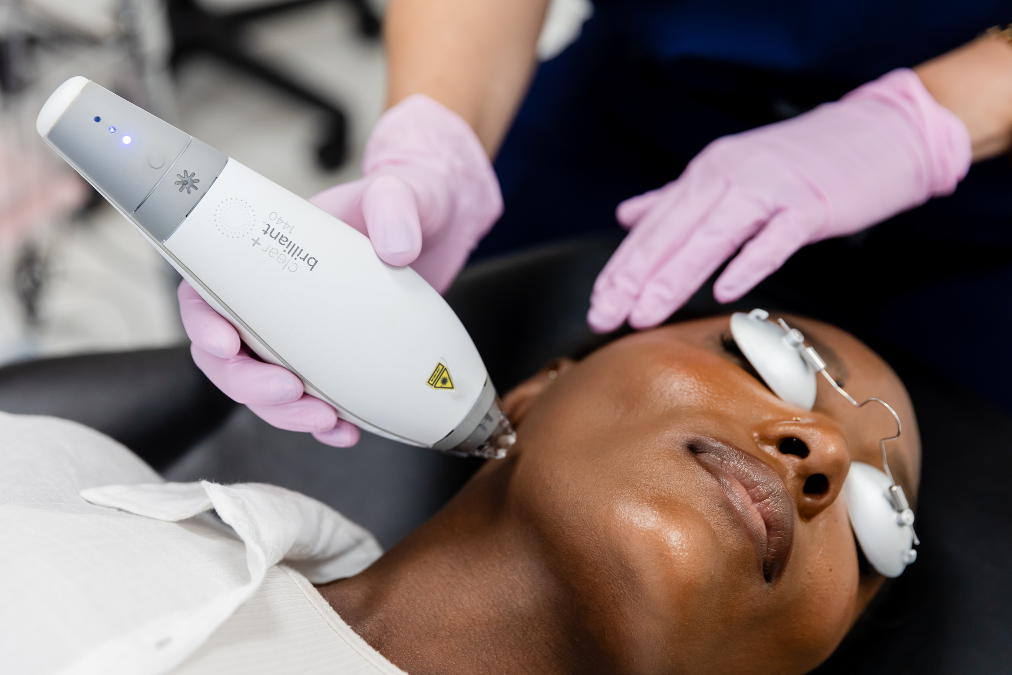 A client gets a Clear + Brilliant laser treatments in Philadelphia at About Face Aesthetics