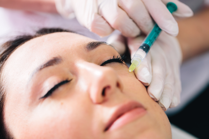 Injectable tissue stimulator on woman face in beauty salon as she gets Under Eye Filler Philadelphia